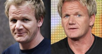 British chef Gordon Ramsay: before and after getting his wrinkles lasered out