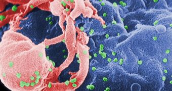 HIV Vaccine Pressures the Virus at Genetic Level