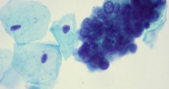 Purple stains the HPV virus inside cells