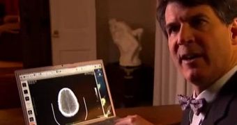 Dr. Eben Alexander suffered from coli meningitis infection affected parts of his brain, yet he survived