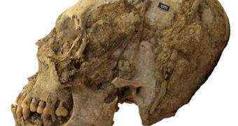 Cranial deformation found at El Trigal