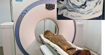 Mummy being analyzed with a CT scan machine, for signs of heart conditions. Because the hearts were missing, only arteries could be analyzed