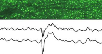 Brain neurons (green) with a faulty potassium channel. An EEG and an EKG show that epileptic seizures (top) often coincide with heart arrhythmias (bottom) in mice