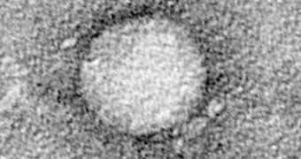EM image showing the hepatitis C virus