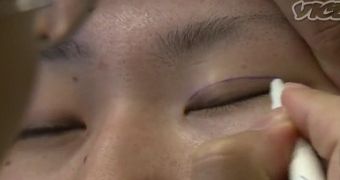 Hot in South Korea: Double Eyelid Plastic Surgery