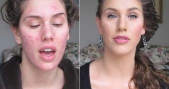 Cassandra Bankson: before and after