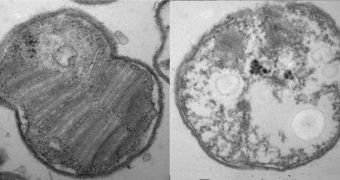 Newly discovered gene helps bacteria survive in low-oxygen environments. A bacterial cell with the gene (left) exhibits a protective membrane. A cell without the gene produces no membranes