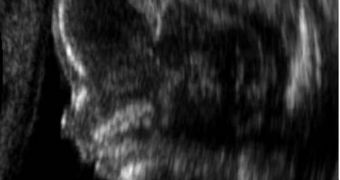 In medicine, ultrasounds have been used only to create accurate representations of babies inside their mothers' wombs until now