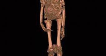 An image from a 2005 CT scan of King Tut's mummy. Results of the scan indicated the boy king was not murdered but may have suffered a badly broken leg shortly before his death. A new theory suggests that Tut died after falling from his chariot while