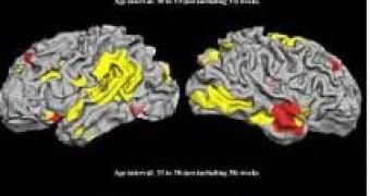 Premature brains (top and middle), children brains (bottom)