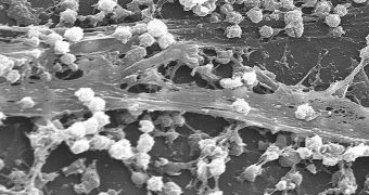 This is a Staphylococcus aureus biofilm on the tip of an implanted catheter