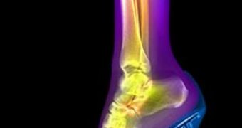 Woman foot in stiletto, seen in X-rays