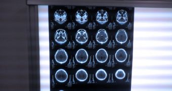Judges are still unsure whether they should accept fMRI scans as evidence in capital-crime cases