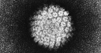 This is a TEM image of the Human Papilloma Virus