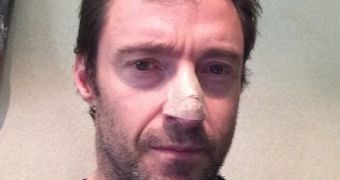 Hugh Jackman has been diagnosed with skin cancer, has had surgery to remove it