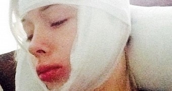 Valeria Lukyanova, aka the original Human Barbie, after being discharged from the hospital after hate attack