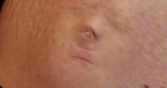 A photo of Karen McMartin's baby bump reveals a human face
