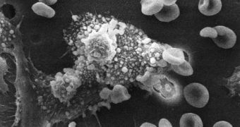 Macrophage immune system cells killing cancer cells