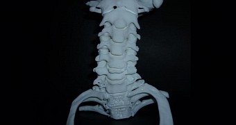 Damaged spine scan