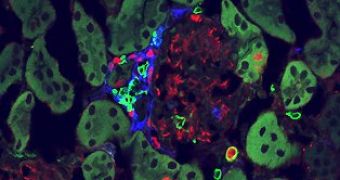 Immune Cells Responsible for Lupus