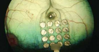 Implant That Projects Words Directly onto the Retina Has Been Invented