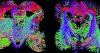 mages of the developing fetal brain show connections among brain regions