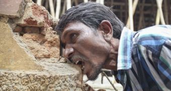 Man in India says he likes to eat mud, stones, and bricks