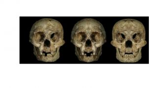 Views intended to illustrate facial assymetry in the “hobbit” human: A (left) is the actual specimen, B (middle) is the right side doubled at the midline and mirrored, and C (right) is the left side doubled and mirrored