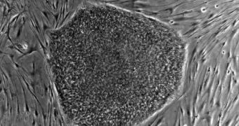 Umbilical cord stem cells could hold the key to creating perfectly-matched heart valves for infants