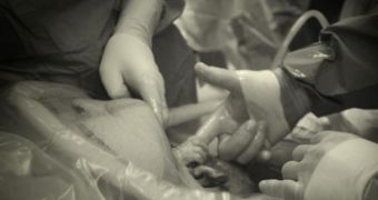 Infant in Womb Shown Holding Doctor's Hand During C-Section – Photo