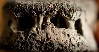 Infectious Disease Found in Ancient Skeletal Remains