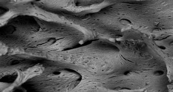 New biopatch developed at the University of Iowa can replace damaged bone tissue by using DNA-laden nanoparticles