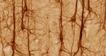 SMI32-stained pyramidal neurons in cerebral cortex