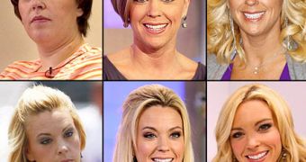Kate Gosselin throughout the years