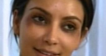 Bruised and sore Kim Kardashian swears off Botox until she’s 40