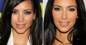 Kim Kardashian’s face has changed through the years: before and after