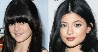 Kylie Jenner's lips have changed a lot in size in the past year or so