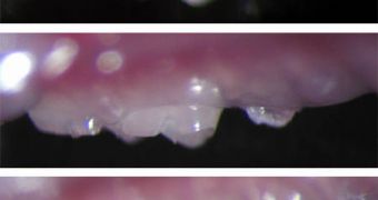 A bioengineered tooth germ placed in the jaw of a mouse (top) buds through the gum at 36 days (center) and fully grows in after 49 days (bottom)