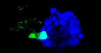 The cerebral pineal complex of a transgenic zebrafish larvae, with glowing proteins
