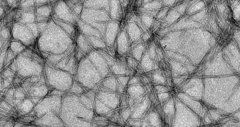 Amyloid fibrils like those magnified here 12,000 times are thought to be the cause of plaques in the brains of Alzheimer's disease patients