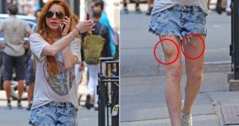 Lindasy Lohan manages to injure herself pretty badly by falling off a bike during a trip to New York
