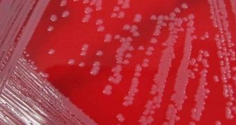 This image shows a spreading MRSA colony