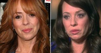 Mackenzie Phillips, before and after “investing” $50,000 in Botox, Restylane and laser treatments
