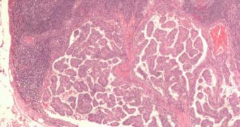 Macrophage Protein Boosts Tumor Growth