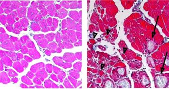 This microscopy image, taken ten days after injury, shows that the muscle fibers of normal mice (left) had regrown, while in mice that couldn’t boost C/EBP production (right), there were still many fibers that had not regenerated