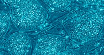 Making Stem Cells Live Longer