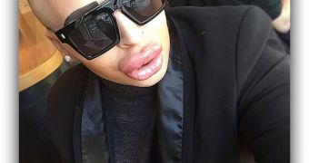 Male Fan Spends $150,000 (€122,236) on Plastic Surgery to Look like Kim Kardashian – Gallery
