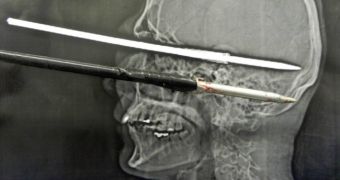 Man survives after shooting himself with a harpoon