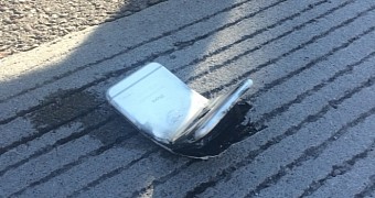 Man Gets 2nd-Degree Burns from Bent iPhone 6 – Gallery