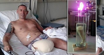 This man tried to sell his amputated leg turned into a lamp on eBay